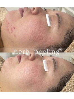 スリリアン 銀座/★お客さまビフォーアフター★