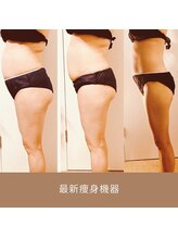 リム ビューティー(RYM BEAUTY)/最新痩身機器最新