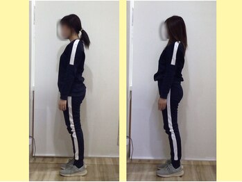 はぴねす鍼灸整骨院 玉造院