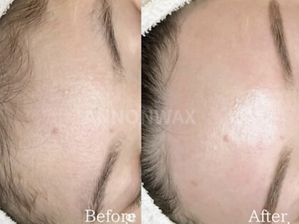 ポアラ(POARA)の写真