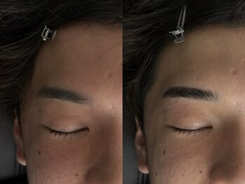 ラトリエ(L'Atelier)/HBL｜before/after