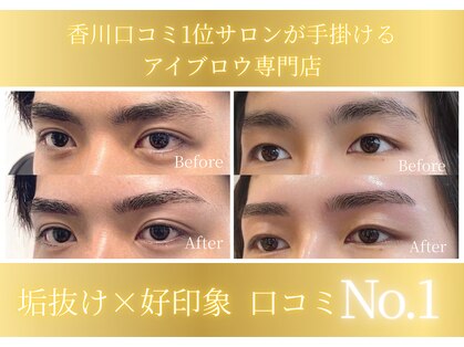 アルデオンワン(ARDEON.1)の写真
