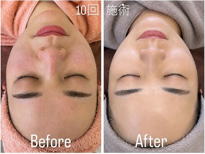 リッシュ 骨盤革命(RICHE.)の写真