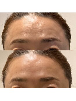 オーブ たかまつはり灸整骨院くじら館(aube)/