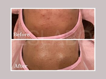 エスラボ オオサカ 心斎橋/本気の肌質改善