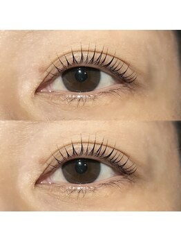 アネラ(ANERA)/パリジェンヌリフト