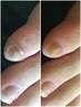 【足裏・足爪のお手入れ】甘皮ケア・足裏角質除去でもちもちなお足元へ￥4980