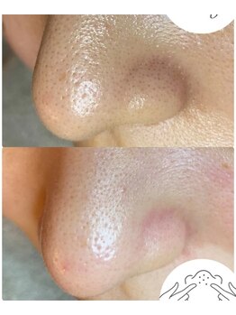 エヌ ドット ジュウイチ(N.11)/黒ずみ毛穴洗浄