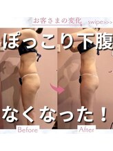 ビューティエン(beauty EN)/痩身ダイエットマッサージエステ