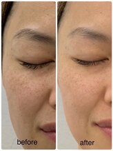 サロン ド ルル(salon de Lulu)/人気No. 1★セルキュア