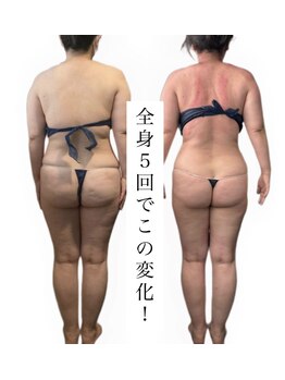 痩身革命 大宮店/ダイエットリンパマッサージ