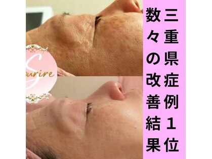 スリール(sourire)の写真