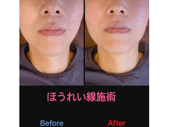 美容矯正サロン レレポノ(LELEPONO)/