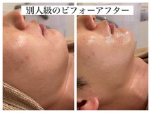 シャルム(Charme)