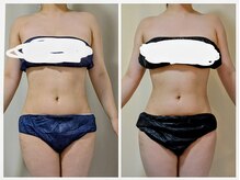 ひぺりかむ/月1メンテナンス