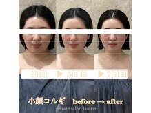 小顔コルギで小顔効果、むくみ解消、リフトアップ、首肩こり改善