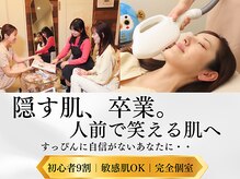 フォーティチュード(FORTITUDE)