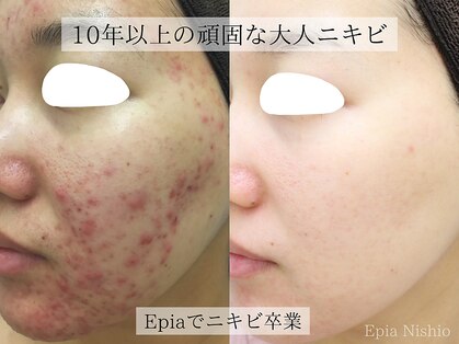 エピア 西尾店(Epia)の写真