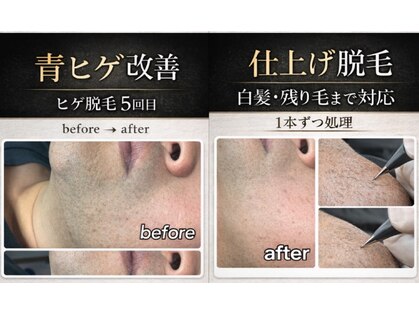 美プラス(美+)の写真