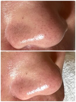 サイセイ(SAISEI)/お試しでこの結果!