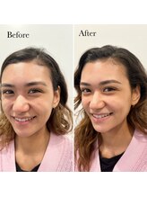 トミー(Tommy)/アイブロウスタイリング