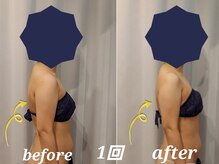 コリ チル(Kori Chill)/【ハイパー Before→After】