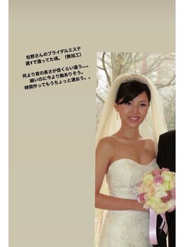 ローズボディ 恵比寿店/細いのに胸ある!小顔バストup