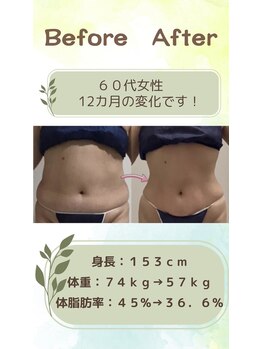 リシャイン(Reshine)/ダイエットＢＡ