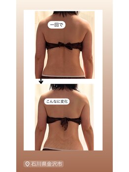 サロン ド エムジョリー(Salon de M Jolie)/リポセラorレモンボトル追加で