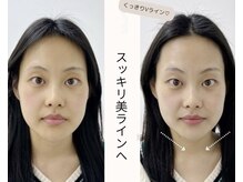 センガン(SENGAN)