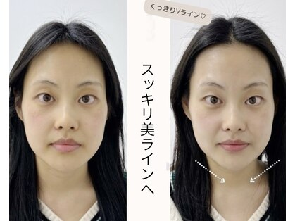 センガン(SENGAN)の写真