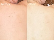 ハダケア(HADA CARE)/美白大作戦★ふわっと泡美白