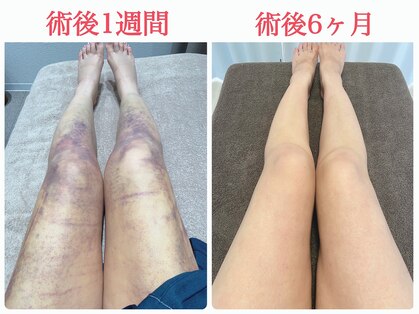 コジー(Cozy)の写真