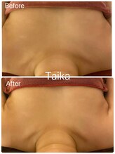 タイカ(Taika)/横流れを前に整えるバストケア