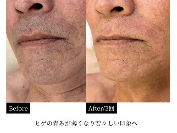 ダイヤ 名古屋中川区店(Daiya)/【他店10回の変化実例】3回経過