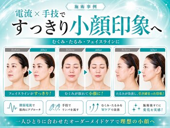 エテの写真/小顔リフトヘッドスパ