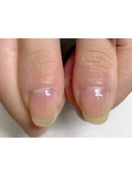 爪の悩みを解消できる（ケア含む）