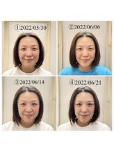 蒼月(aotsuki)/Before/After 