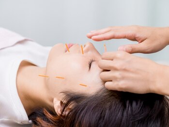 たいよう美容鍼灸院/美容鍼