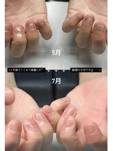 ネイルマン 横浜店(Nail Man)/自爪の育成/ビフォー＆アフター