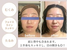 エヌプラスビューティー(N+beauty)の雰囲気（寝落ちする人続出！程よい圧でたるみ/むくみ改善、一回り小顔へ）