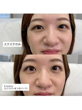 ハイク バイ ジェン(HIKE by gen.)/アンドヘルシー