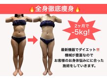 エステティック レイビス 池袋店(RAYVIS)