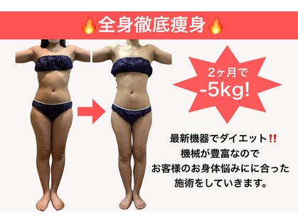 エステティック レイビス 池袋店(RAYVIS)の写真