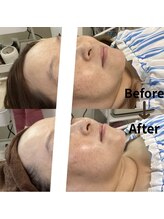 リアンダ(Rianda)/