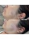 ミィ(mi)の写真/自己処理が難しいおでこの産毛や、もみあげの産毛もナチュラルにWAXで整えることができます☆