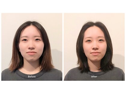 いとう美容整体の写真