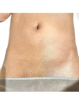 ミーエイト(Mii∞)/《VIO脱毛の効果》