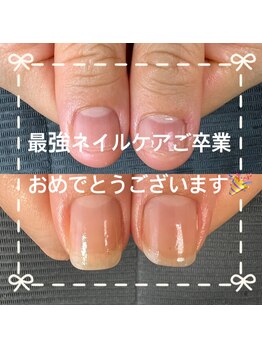 ピュアティネイル(purity nail)/最強ネイルケア