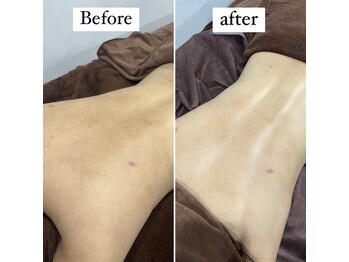 ロザブルー(ROSA BLU)/before/after 